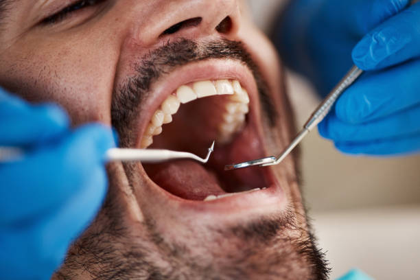 Best Emergency Dental Surgery in Erie, KS